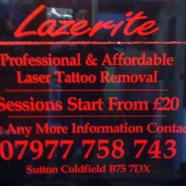 Lazerite Tattoo Removal